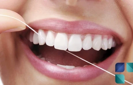 Periodontia em Curitiba